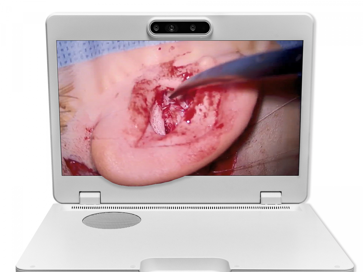 达擎之＂Heads-up 3D显微手术显示系统＂，整合4K裸眼3D显示及眼球追踪系统，具备快速追踪人眼移动位置功能，减轻医师长时间维持固定姿势的负担，让医师能有更宽广清晰的3D立体视野及更舒适的姿势来执行手术。